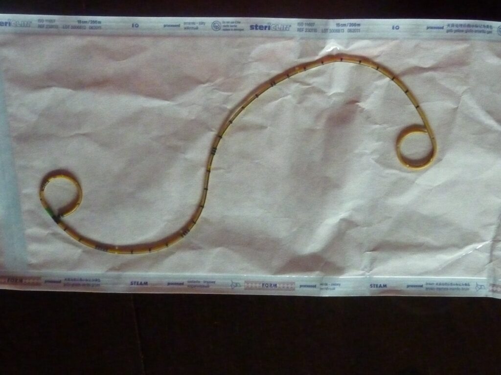 Die zweite Ureterschiene (28 cm lang), wurde exakt nach 3 Monaten in Narkose entfernt